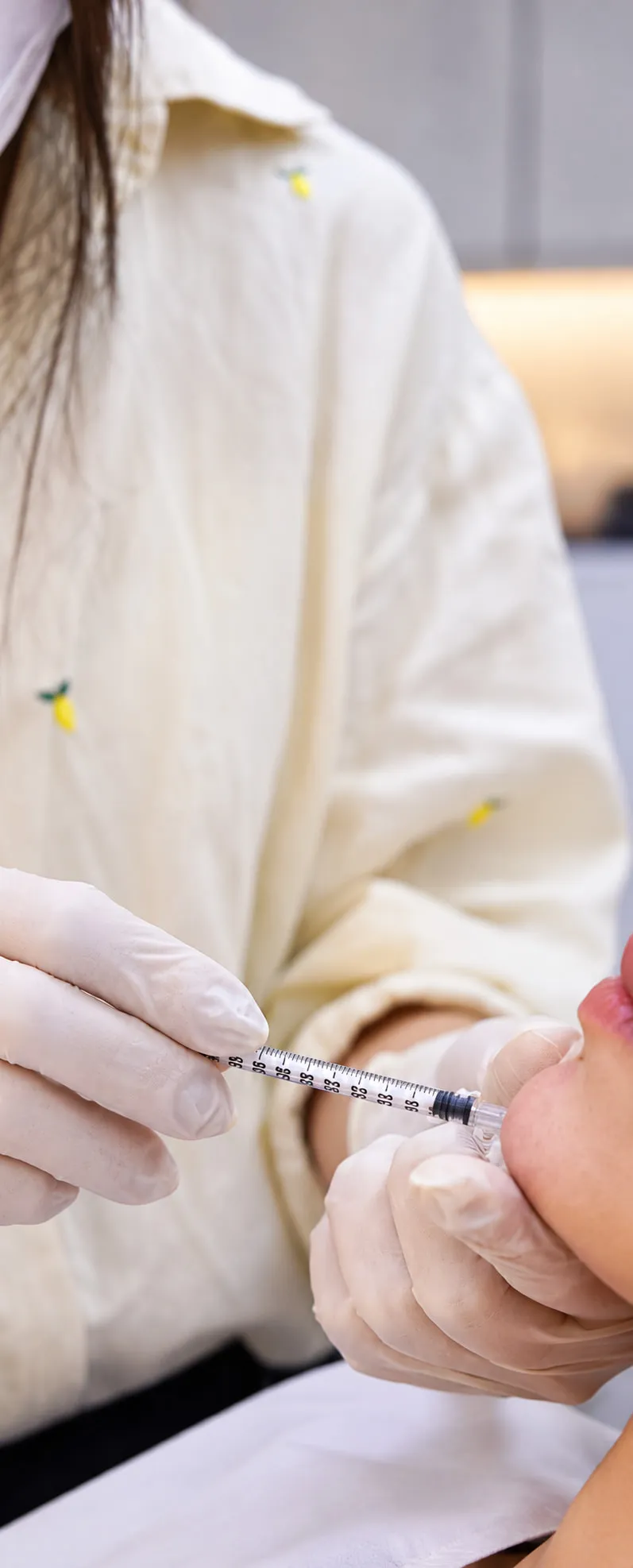 Aplicação de preenchimento labial com seringa, feita com luvas